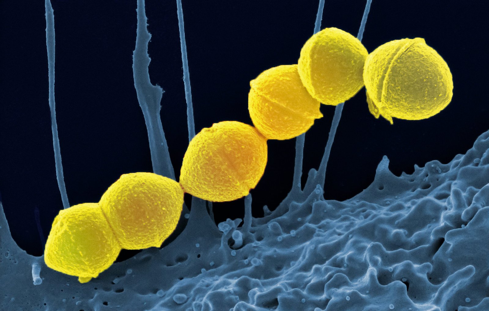 Veillonella can lower the growth barrier for Porphyromonas gingivalis