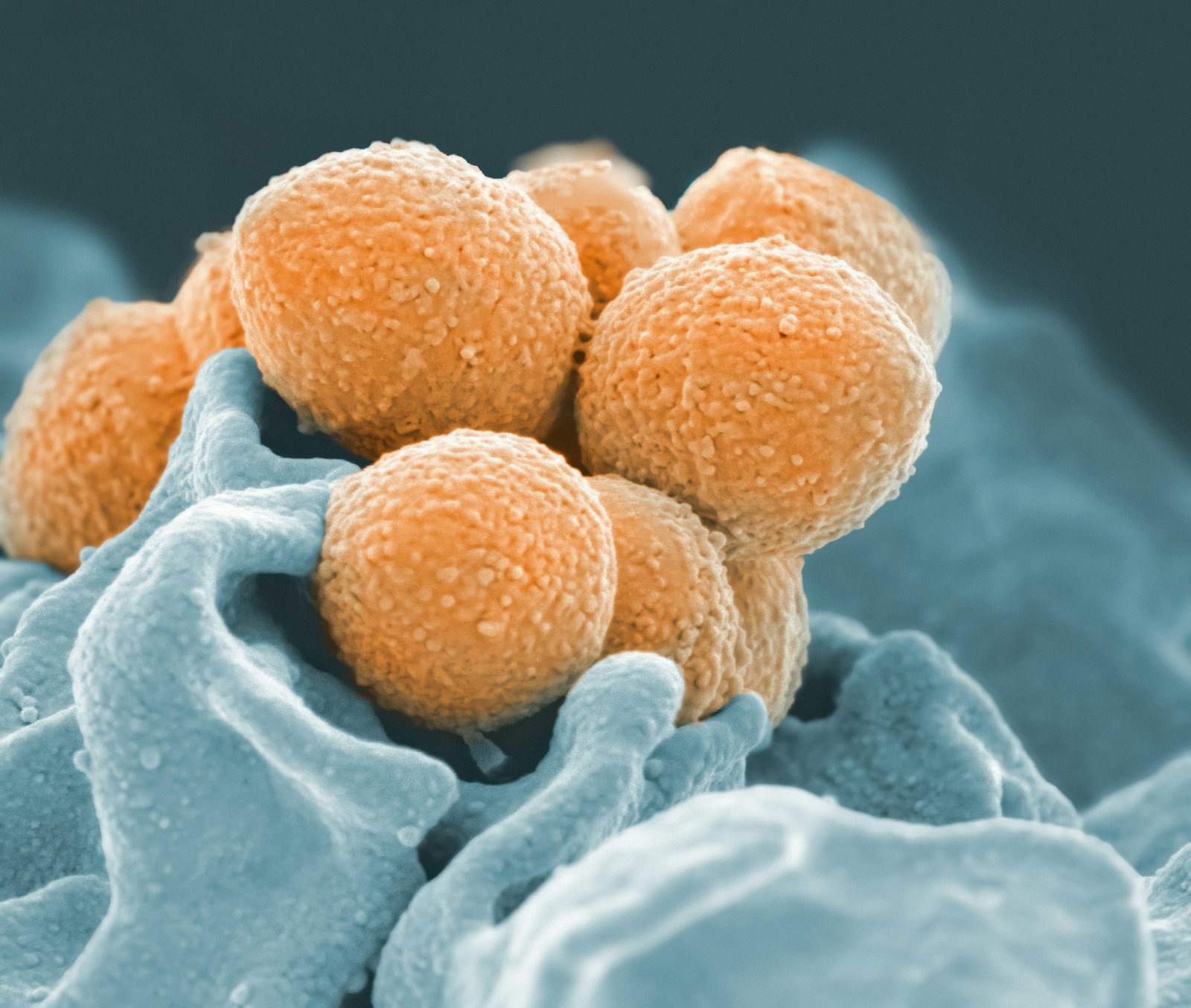 Gut microbiota shifts and possible markers linked to postoperative enterocolitis