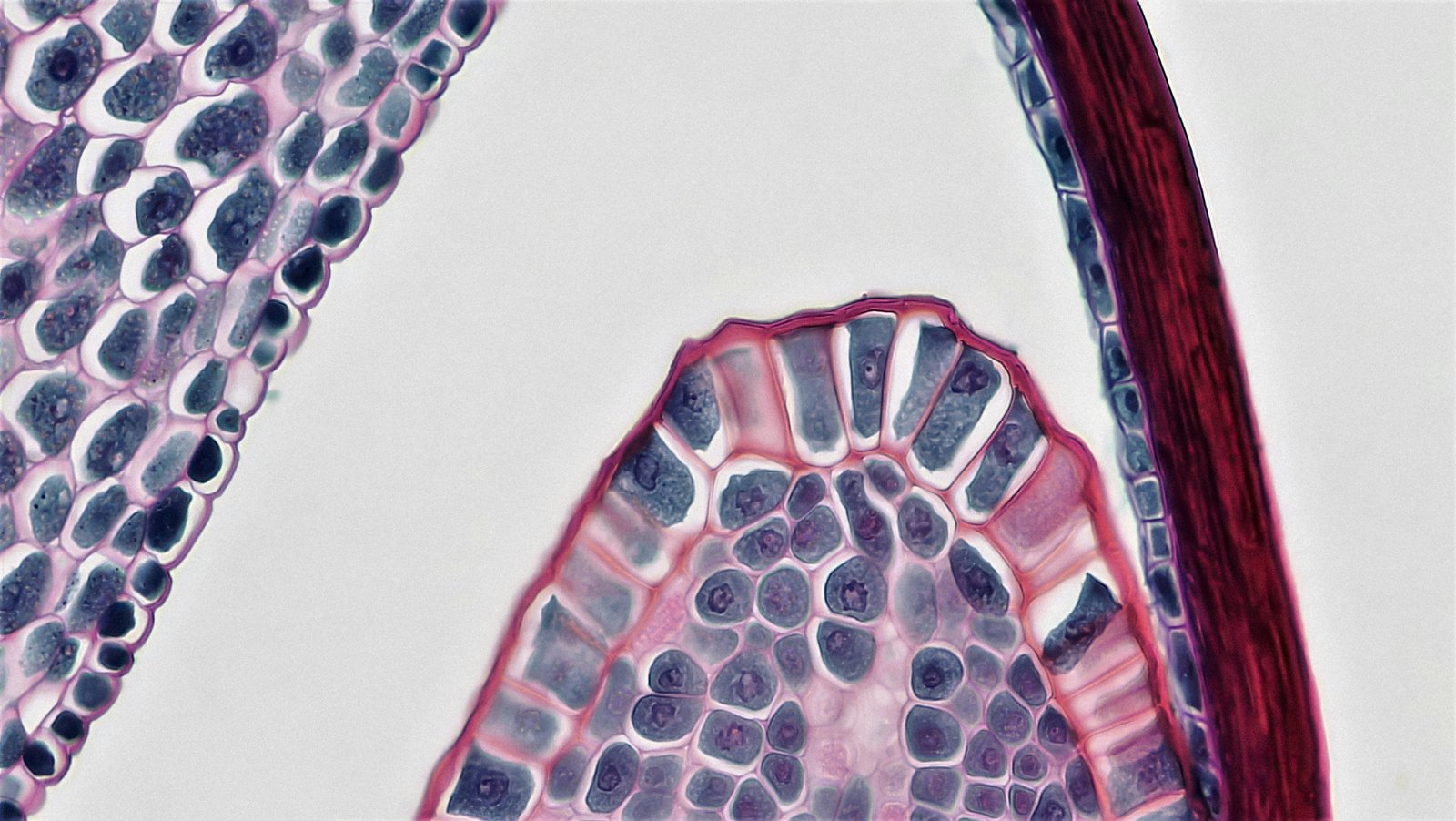 Craniofacial fibrous dysplasia osteoblasts show altered bone homeostasis