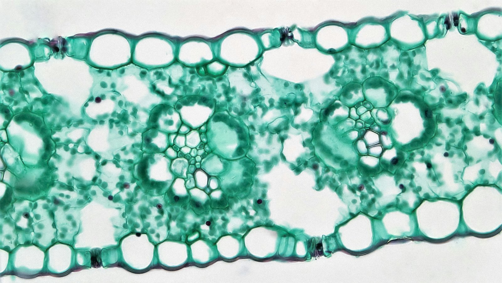 Some spinal implant particles did not activate glial cells