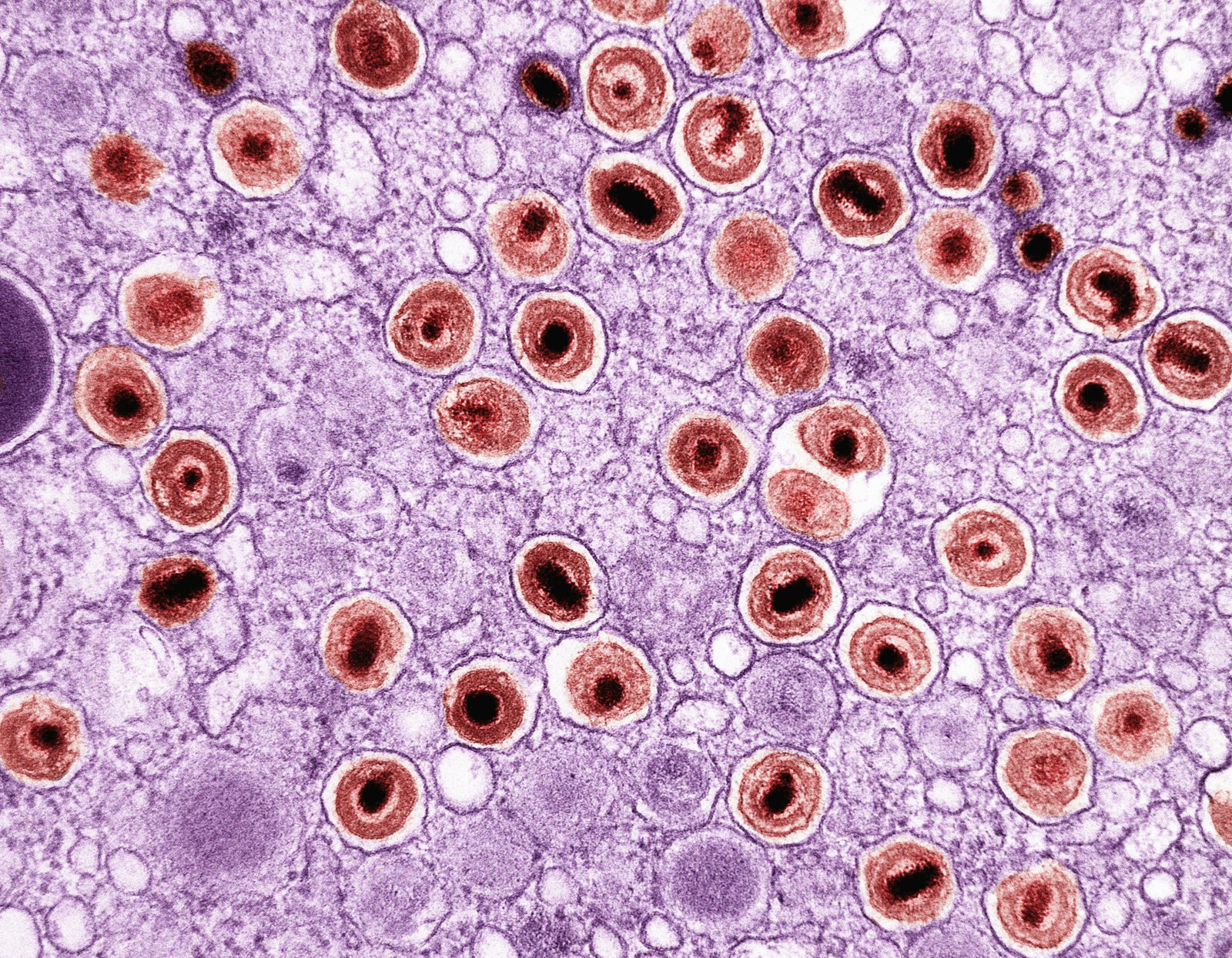 Neurodegeneration, Oxidative Stress, NGF/TrkA/P75NTR, and PGE2 Dysregulation Induced by PFOS Single and Repeated Treatment: Partial Protection by T3 and Other Therapeutic Approaches