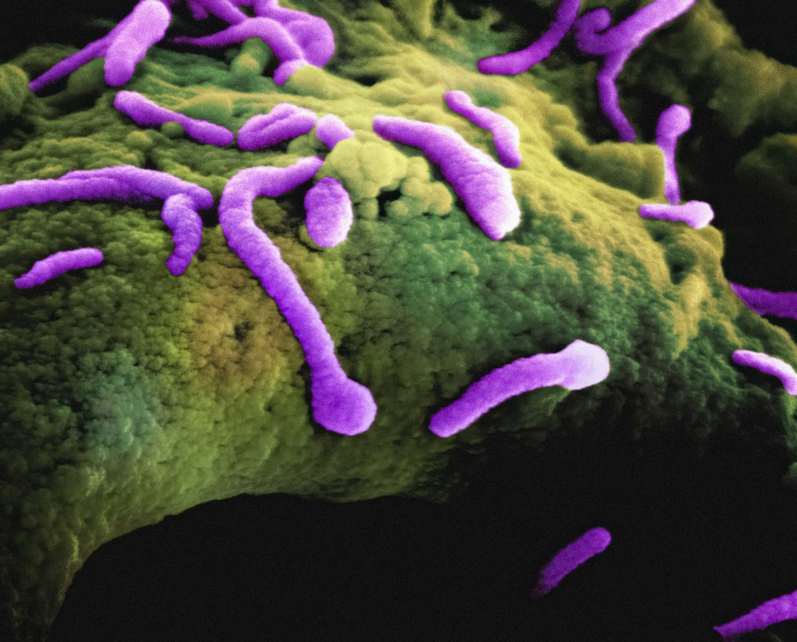 Ecological network balance index distinguishes healthy and dysbiotic gut states